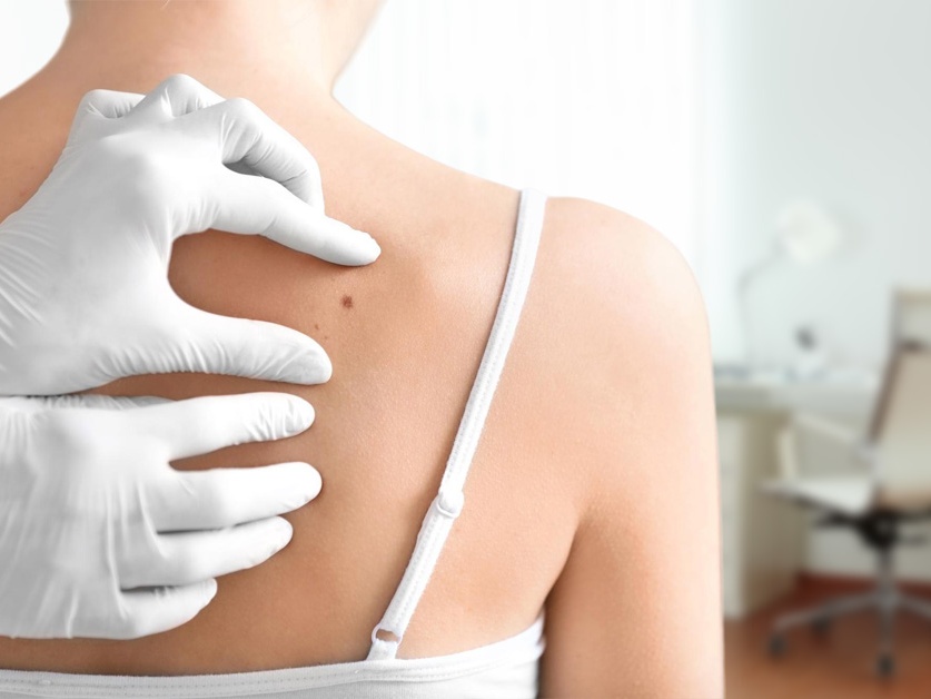 Kožní ordinace - MUDr. Kateřina Starková