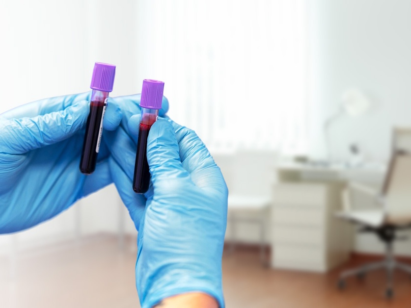 Odběry krve - Oblastní nemocnice Příbram (Poliklinika RAVAK)